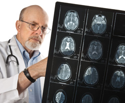 Creierul si obezitatea 2 creier, tomografie