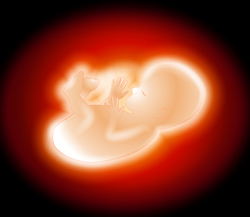 Durerea autista 2 fetus, copil, mediu, separare