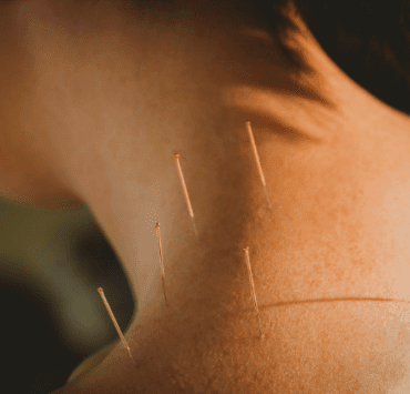 Acupunctura și activarea arhetipurilor 9 acupunctura-și-activarea-arhetipurilor