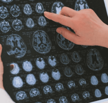 Învățarea și neuroplasticitatea în creierul adult 7 învățarea-și-neuroplasticitatea-în-creierul-adult