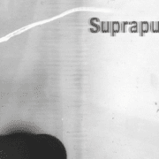 2-3-galeria-prezintă-proiectul-fotografic-colaborativ-suprapuneri