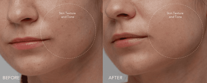 FOREO: noua mască de față KIWI™ Active Pore & Black Head Mask 7 Screenshot 38