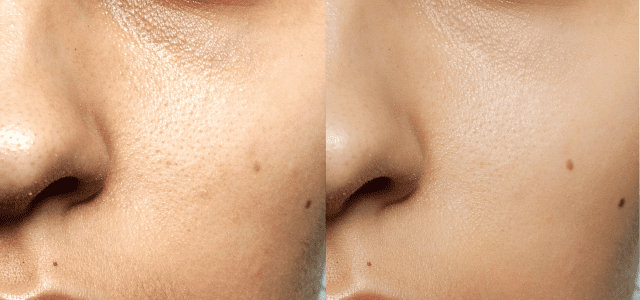 FOREO lansează KIWI™ Oil Control Mattifying Moisturizer - baza de machiaj pentru un ten gras 3 foreo kiwi oil int 2