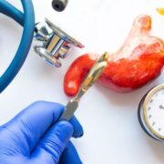 chirurgie bariatrica 1589254615