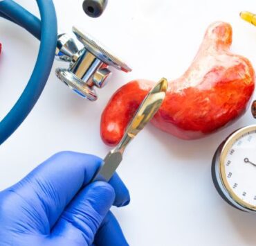 chirurgie bariatrica 1589254615