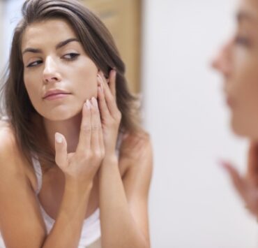 roseatacauzatadeacnee