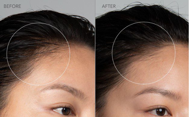 FOREO lansează soluția perfectă pentru un păr sănătos și bogat: LUNA™ 4 hair 6 Screenshot 90