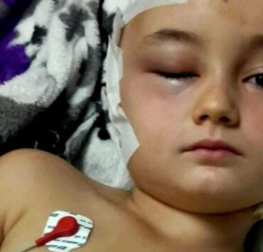 Nicoleta, o fetiță de 10 ani care luptă cu cancerul: „Vreau doar să fiu bine și să mă pot juca iar cu copiii!” 10 nicoleta 1