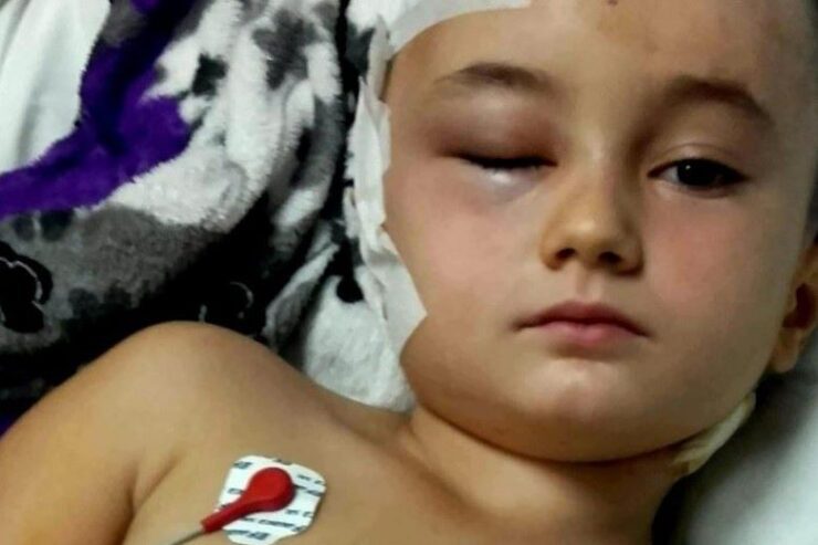 Nicoleta, o fetiță de 10 ani care luptă cu cancerul: „Vreau doar să fiu bine și să mă pot juca iar cu copiii!” 28 nicoleta 1