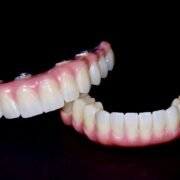 Alimentația după un implant dentar: ce alimente ajută la o vindecare rapidă