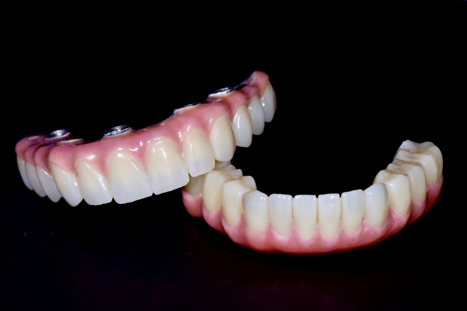 Alimentația după un implant dentar: ce alimente ajută la o vindecare rapidă