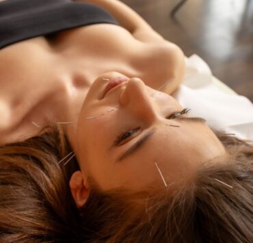 Acupunctura emoțională: cadoul care nu se pune sub brad, dar rămâne mult după sărbători