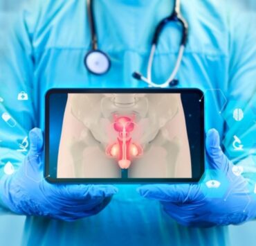 Varicocelul: cauze, simptome și opțiuni de tratament