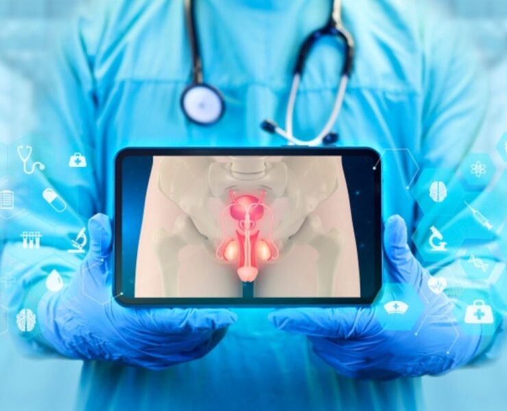 Varicocelul: cauze, simptome și opțiuni de tratament