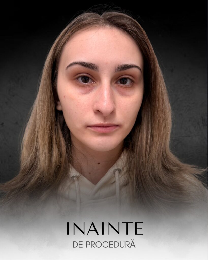 Îngrijirea pielii: cum influențează starea de bine și încrederea în sine 3 WhatsApp Image 2026 02 26 at 12.23.381