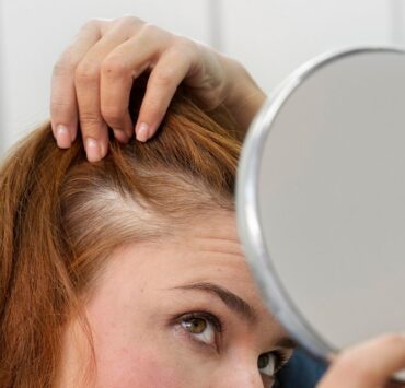 implantul de par si hipotiroidism